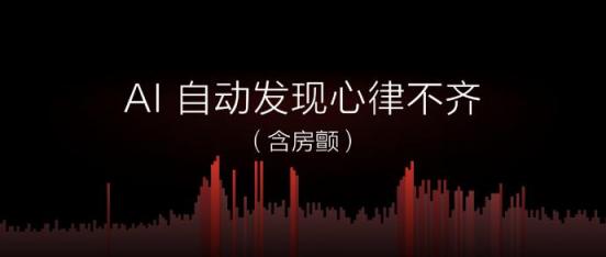 房颤心律不齐高效预警 AMAZFIT米动健康手环1S成护心神器