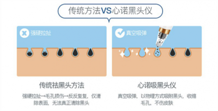 双11最值得入手的面部清洁电器！美国心诺黑头仪价格直降一半！