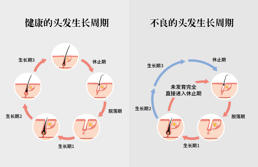 拯救头顶大事，采用创新配方REDENICAL的DR ZERO来到中国