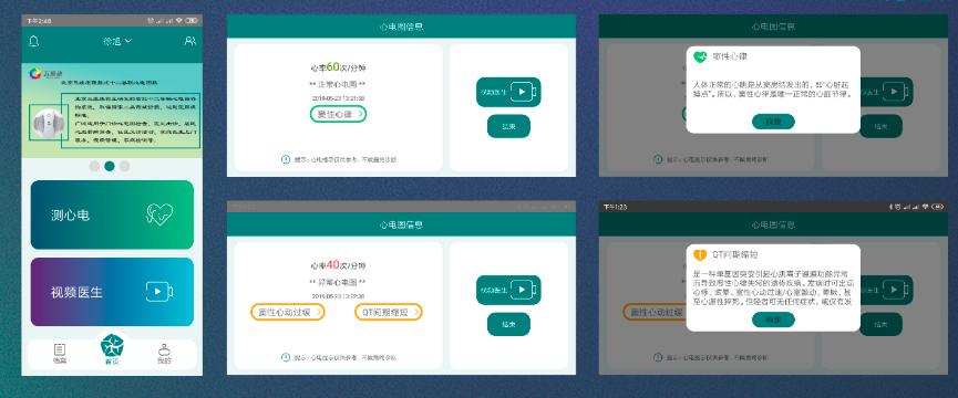 医学黑科技“飞碟心电仪”，居家快速鉴别心肌梗死成现实