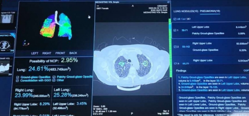 厄瓜多尔卫生部正式启用基于华为云的新冠肺炎AI辅助筛查系统