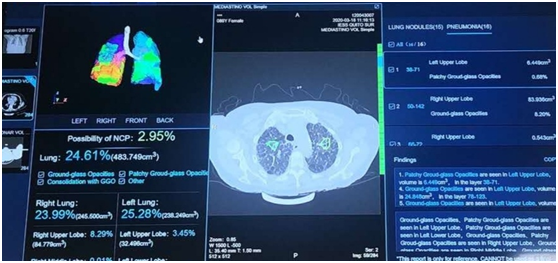 厄瓜多尔副总统感谢华为云紧急助力部署新冠肺炎AI辅助筛查系统