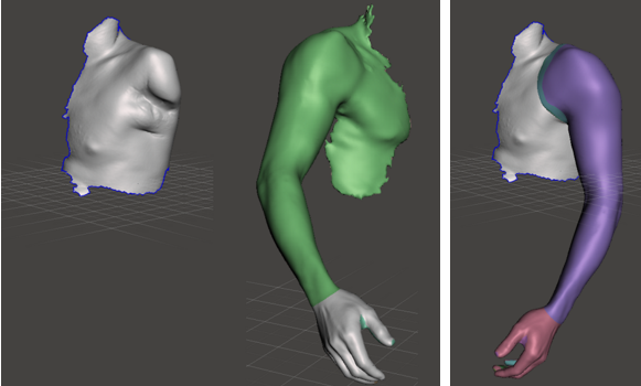 先临三维3D数字化解决方案，援助塞拉利昂 3D Sierra Leone 医疗辅具定制项目