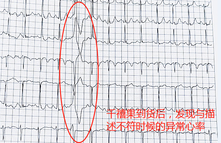 618网购致老人多次心率异常 ?医生提示要选有保障的网购平台