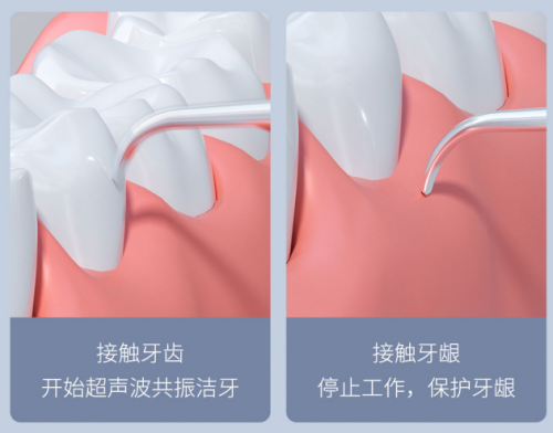 小米有品全球首发众筹，仅售199！素诺智能可视超声波洁牙仪T11Pro开抢