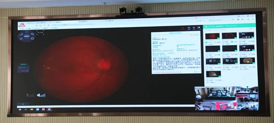 致远慧图利用“AI+远程”技术，助力全疆首例5G远程眼底激光治疗顺利完成