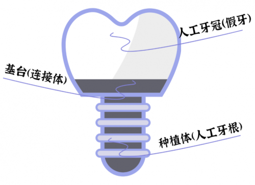 缺一两颗牙没关系，这届年轻人的想法真的很危险