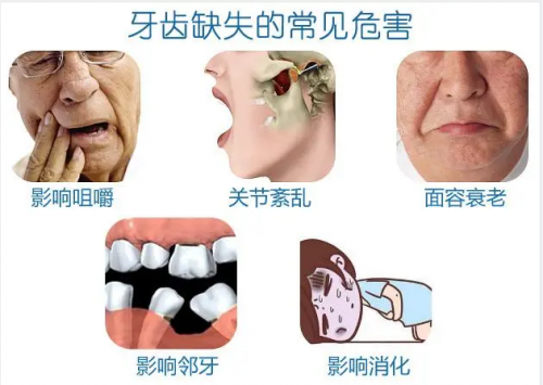 缺一两颗牙没关系，这届年轻人的想法真的很危险