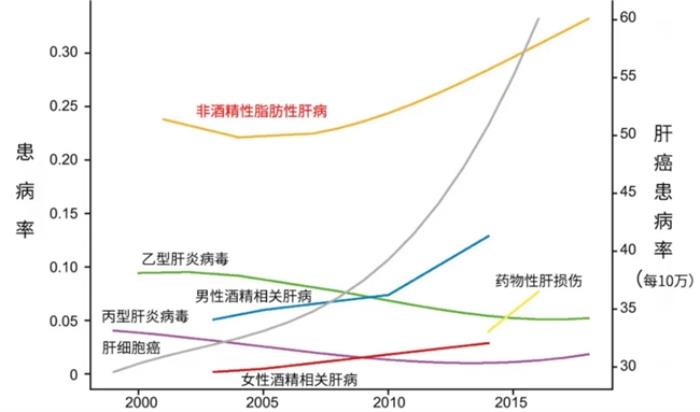 中国非酒精性脂肪肝泛滥，西班牙plameca波利王益肝露拯救代谢危机