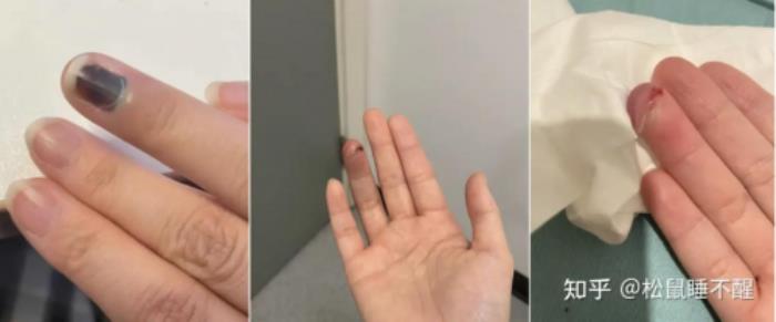智能门锁夹手之痛引爆全网 一场席卷社交媒体的安全拷问