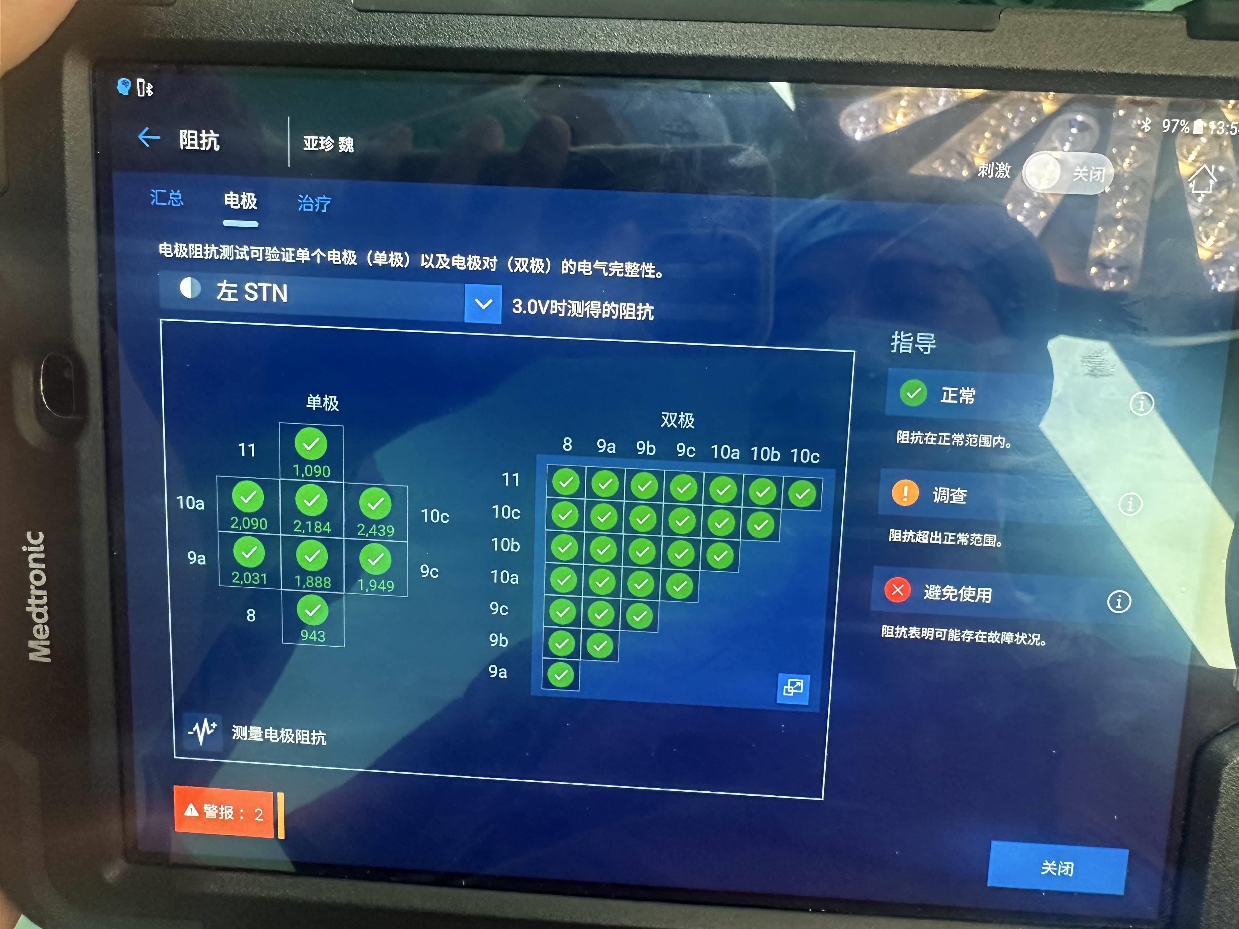 西部首例，高科技机器人辅助方向性电极植入在西安市人民医院（西安市第四医院）实施